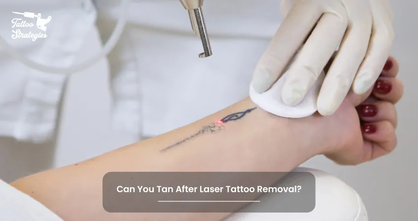Can You Tan After Laser Tattoo Removal