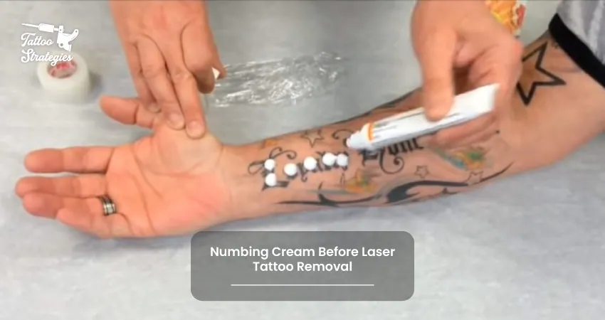 Numbing Cream Before Laser Tattoo Removal