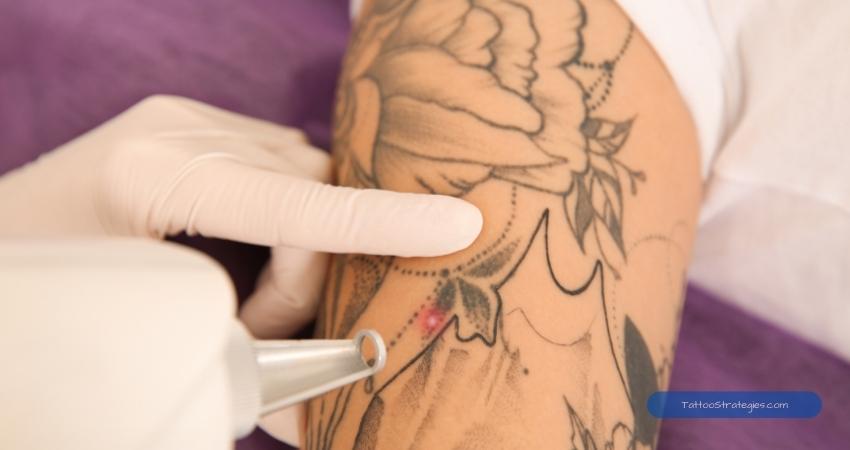 laser tattoo removal1 - Tattoo Strategies