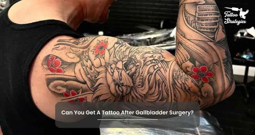Can You Get A Tattoo After Gallbladder Surgery - Tattoo Strategies