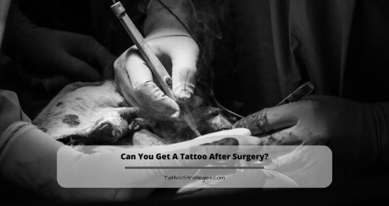 Can You Get A Tattoo After Surgery?