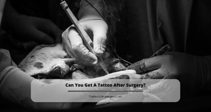 Can You Get A Tattoo After Surgery?