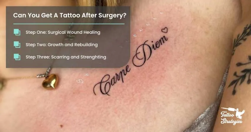 Can You Get A Tattoo After Surgery - Tattoo Strategies