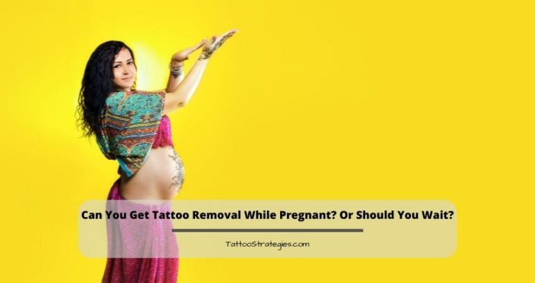 Can You Get Tattoo Removal While Pregnant? Or Should You Wait?