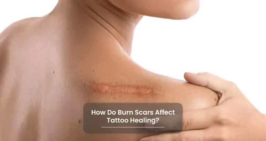 How Do Burn Scars Affect Tattoo Healing - Tattoo Strategies