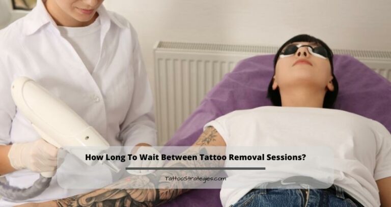 How Long To Wait Between Tattoo Removal Sessions?