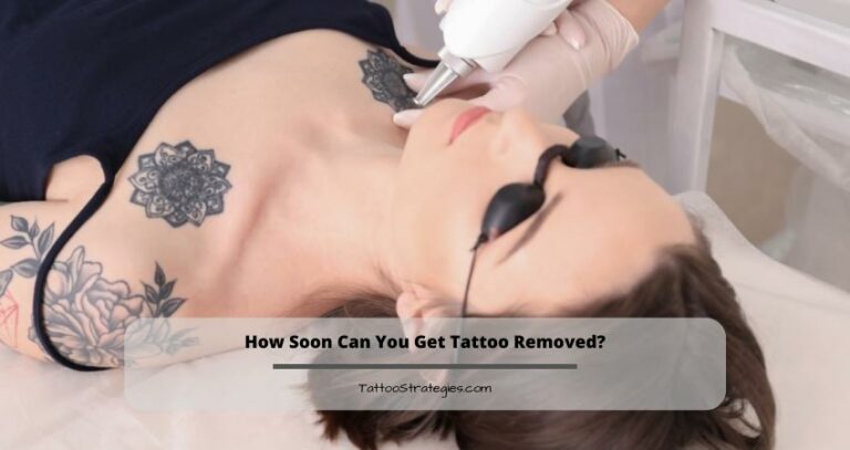 How Soon Can You Get Tattoo Removed?