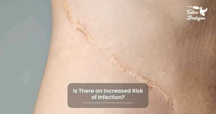 Is There an Increased Risk of Infection - Tattoo Strategies