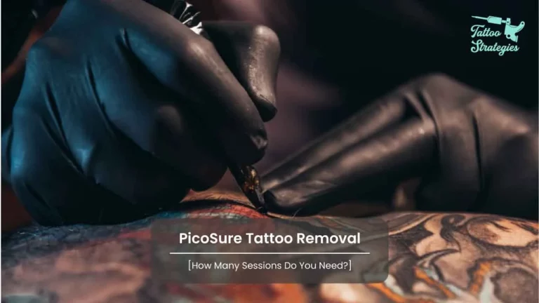 PicoSure Tattoo Removal: [How Many Sessions Do You Need?]