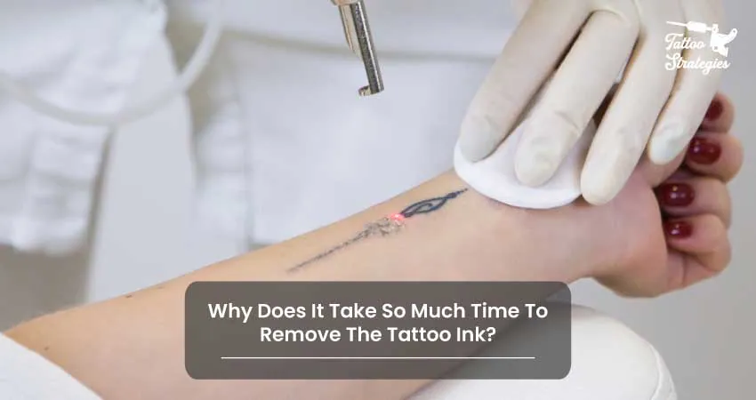 Why Does It Take So Much Time To Remove The Tattoo Ink - Tattoo Strategies