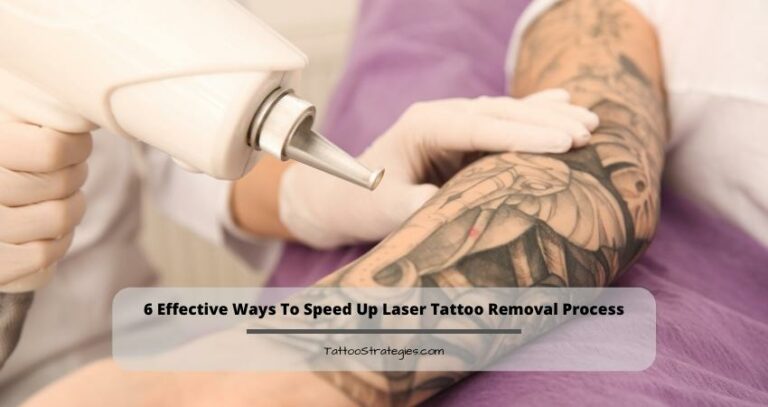 6 Effective Ways To Speed Up Laser Tattoo Removal Process
