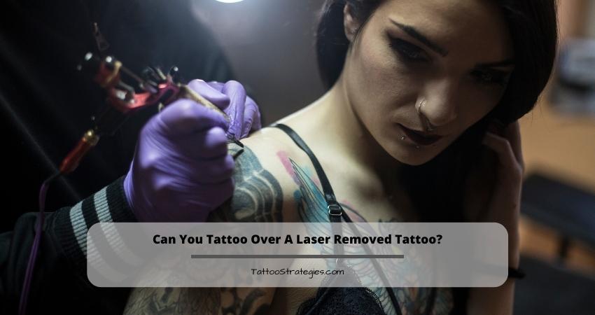 Can You Tattoo Over A Laser Removed Tattoo?